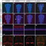 Rabbit IgG (H+L) Cross-Adsorbed Secondary Antibody in Immunohistochemistry (IHC)