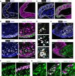 Mouse IgG (H+L) Highly Cross-Adsorbed Secondary Antibody in Immunohistochemistry (IHC)