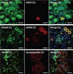 Goat IgG (H+L) Cross-Adsorbed Secondary Antibody in Immunohistochemistry (Frozen) (IHC (F))