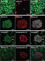 Goat IgG (H+L) Cross-Adsorbed Secondary Antibody in Immunohistochemistry (Frozen) (IHC (F))