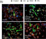 Mouse IgG (H+L) Cross-Adsorbed Secondary Antibody in Immunocytochemistry (ICC/IF)