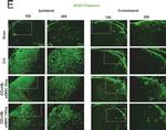 Guinea Pig IgG (H+L) Highly Cross-Adsorbed Secondary Antibody in Immunohistochemistry (PFA fixed) (IHC (PFA))