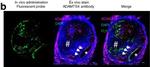 Rabbit IgG (H+L) Secondary Antibody in Immunohistochemistry (IHC)