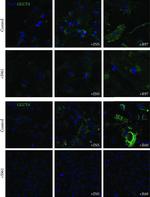 Goat IgG (H+L) Cross-Adsorbed Secondary Antibody in Immunocytochemistry (ICC/IF)