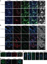 Rabbit IgG (H+L) Highly Cross-Adsorbed Secondary Antibody in Immunocytochemistry (ICC/IF)