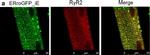 Mouse IgG (H+L) Highly Cross-Adsorbed Secondary Antibody in Immunocytochemistry (ICC/IF)