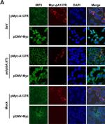 Rabbit IgG (H+L) Highly Cross-Adsorbed Secondary Antibody in Immunocytochemistry (ICC/IF)