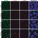 Rabbit IgG (H+L) Cross-Adsorbed Secondary Antibody in Immunocytochemistry (ICC/IF)