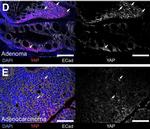 Rabbit IgG (H+L) Highly Cross-Adsorbed Secondary Antibody in Immunohistochemistry (IHC)