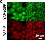 Mouse IgG2a Cross-Adsorbed Secondary Antibody in Immunocytochemistry (ICC/IF)