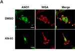 Mouse IgG (H+L) Highly Cross-Adsorbed Secondary Antibody in Immunocytochemistry (ICC/IF)