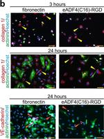 Mouse IgG (H+L) Highly Cross-Adsorbed Secondary Antibody in Immunocytochemistry (ICC/IF)