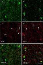 Mouse IgG (H+L) Highly Cross-Adsorbed Secondary Antibody in Immunohistochemistry (IHC)