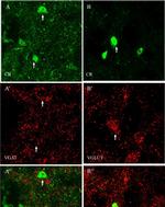 Mouse IgG (H+L) Highly Cross-Adsorbed Secondary Antibody in Immunohistochemistry (IHC)