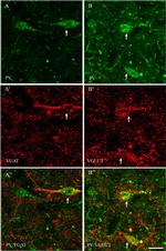 Mouse IgG (H+L) Highly Cross-Adsorbed Secondary Antibody in Immunohistochemistry (IHC)