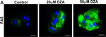 Rabbit IgG (H+L) Highly Cross-Adsorbed Secondary Antibody in Immunocytochemistry (ICC/IF)