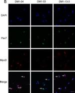 Mouse IgG (H+L) Highly Cross-Adsorbed Secondary Antibody in Immunocytochemistry (ICC/IF)