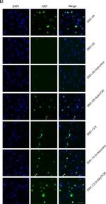 Rabbit IgG (H+L) Highly Cross-Adsorbed Secondary Antibody in Immunocytochemistry (ICC/IF)