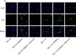 Rabbit IgG (H+L) Highly Cross-Adsorbed Secondary Antibody in Immunocytochemistry (ICC/IF)