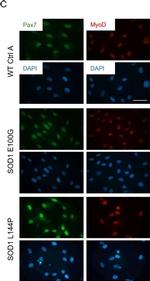 Rabbit IgG (H+L) Highly Cross-Adsorbed Secondary Antibody in Immunocytochemistry (ICC/IF)