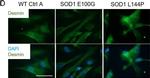 Rabbit IgG (H+L) Highly Cross-Adsorbed Secondary Antibody in Immunocytochemistry (ICC/IF)