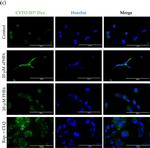 Rabbit IgG (H+L) Highly Cross-Adsorbed Secondary Antibody in Immunocytochemistry (ICC/IF)