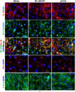 Rabbit IgG (H+L) Highly Cross-Adsorbed Secondary Antibody in Immunocytochemistry (ICC/IF)