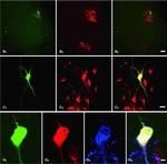 Guinea Pig IgG (H+L) Highly Cross-Adsorbed Secondary Antibody in Immunohistochemistry (PFA fixed) (IHC (PFA))