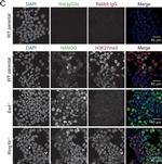 Rat IgG (H+L) Highly Cross-Adsorbed Secondary Antibody in Immunocytochemistry (ICC/IF)