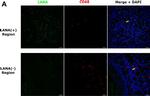 Rat IgG (H+L) Highly Cross-Adsorbed Secondary Antibody in Immunohistochemistry (Paraffin) (IHC (P))