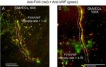 Mouse IgG (H+L) Cross-Adsorbed Secondary Antibody in Immunocytochemistry (ICC/IF)