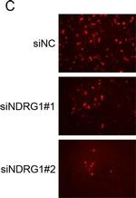 Mouse IgG (H+L) Cross-Adsorbed Secondary Antibody in Immunocytochemistry (ICC/IF)