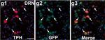 Rabbit IgG (Heavy chain) Secondary Antibody in Immunocytochemistry (ICC/IF)