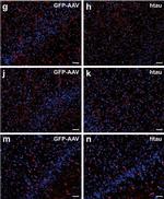 Mouse IgG (H+L) Highly Cross-Adsorbed Secondary Antibody in Immunohistochemistry (IHC)