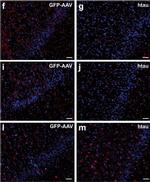 Mouse IgG (H+L) Highly Cross-Adsorbed Secondary Antibody in Immunohistochemistry (IHC)