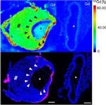 Rabbit IgG (H+L) Highly Cross-Adsorbed Secondary Antibody in Immunohistochemistry (IHC)