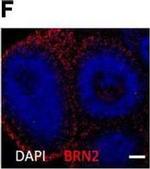 Rabbit IgG (H+L) Highly Cross-Adsorbed Secondary Antibody in Immunohistochemistry (IHC)