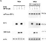 Rabbit IgG (H+L) Poly-HRP Secondary Antibody in Western Blot (WB)