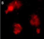 Rabbit IgG (H+L) Cross-Adsorbed Secondary Antibody in Immunohistochemistry (Paraffin) (IHC (P))