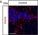 Mouse IgG (H+L) Cross-Adsorbed Secondary Antibody in Immunohistochemistry (PFA fixed) (IHC (PFA))