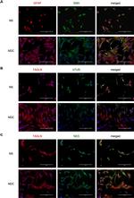 Rabbit IgG (H+L) Cross-Adsorbed Secondary Antibody in Immunocytochemistry (ICC/IF)