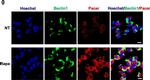 Rabbit IgG (Heavy chain) Secondary Antibody in Immunocytochemistry (ICC/IF)