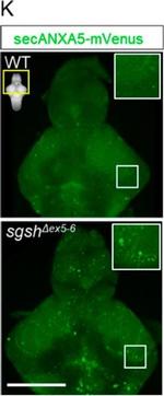 Rabbit IgG (Heavy chain) Secondary Antibody in Immunohistochemistry (IHC)