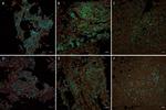 Mouse IgG (H+L) Highly Cross-Adsorbed Secondary Antibody in Immunocytochemistry (ICC/IF)
