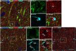 Mouse IgG (H+L) Highly Cross-Adsorbed Secondary Antibody in Immunohistochemistry (IHC)