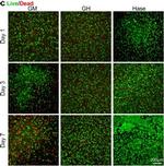 Mouse IgG (H+L) Highly Cross-Adsorbed Secondary Antibody in Immunocytochemistry (ICC/IF)