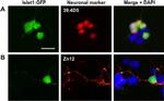 Mouse IgG (H+L) Highly Cross-Adsorbed Secondary Antibody in Immunocytochemistry (ICC/IF)