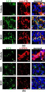 Mouse IgG (H+L) Highly Cross-Adsorbed Secondary Antibody in Immunohistochemistry (IHC)