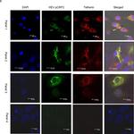 Mouse IgG (H+L) Highly Cross-Adsorbed Secondary Antibody in Immunocytochemistry (ICC/IF)