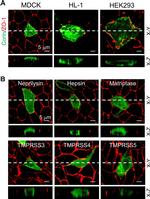 Mouse IgG (H+L) Highly Cross-Adsorbed Secondary Antibody in Immunohistochemistry (Paraffin) (IHC (P))